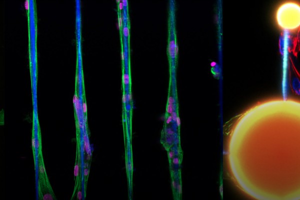 Stem cells