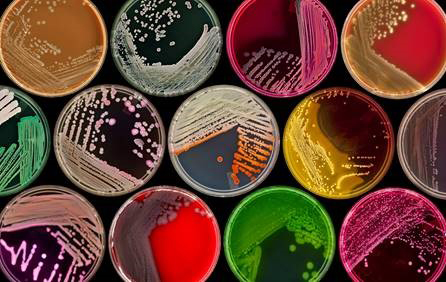 Petri dishes in many different colors