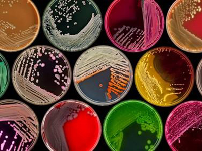Petri dishes containing cultures in many different colors