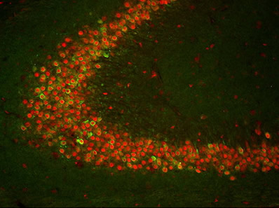 A photo showing the expression of COX-2 (green) and TIA-1 (red) in neurons. Syracuse researchers think TIA-1 suppresses epilepsy in the brain.