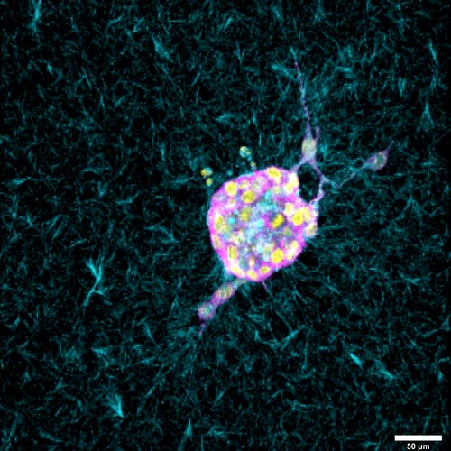 Fluorescence microscope image of a cell amidst fibrous structures, displaying vibrant colors with a scale bar indicating 50 micrometers.