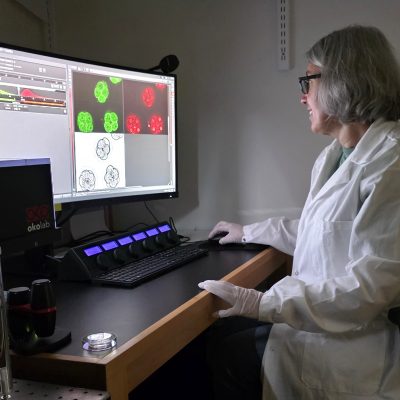 Researcher in white lab coat and gloves working at computer displaying fluorescent microscopy images of cells in green and red, with laboratory equipment visible on desk.