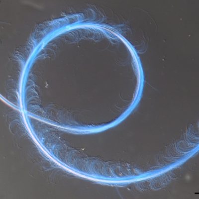 Microscope image of a slender nematode curled into loops, appearing bright blue against a gray background, with a 100 µm scale bar.