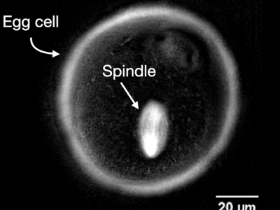 How Physics Could Improve IVF Success