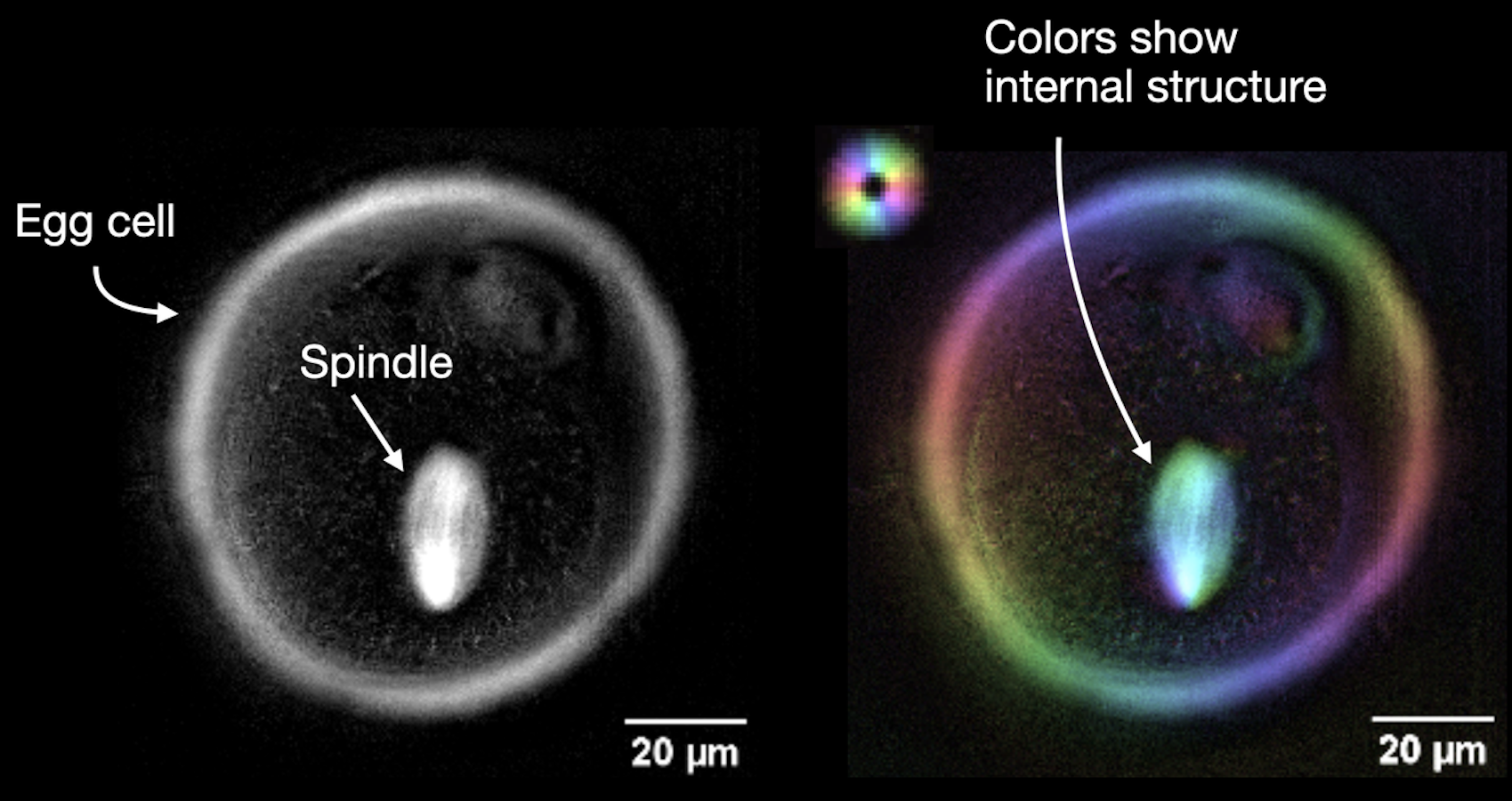 Side-by-side microscope images of an egg cell spindle, showing grayscale and color-enhanced views with labels and 20 µm scale bars.