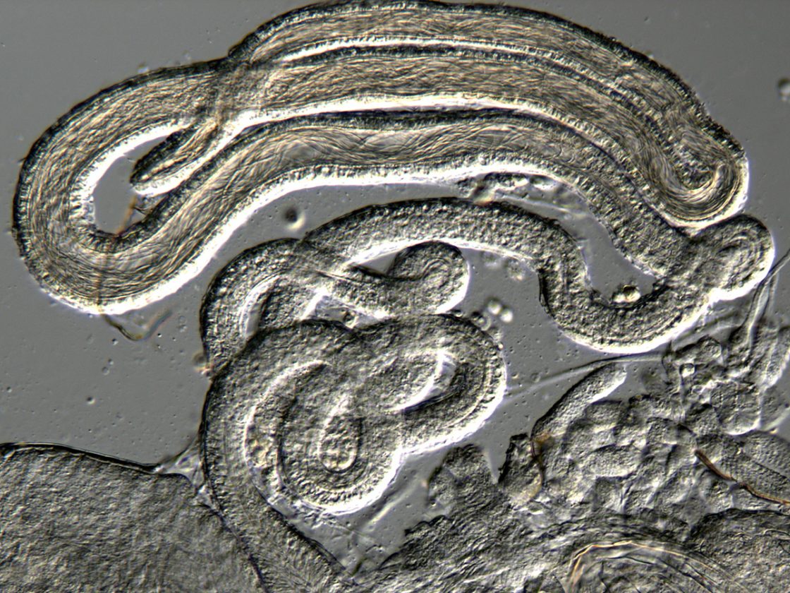 Uncovering Hidden Interactions That Shape Fertility