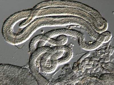 Uncovering Hidden Interactions That Shape Fertility