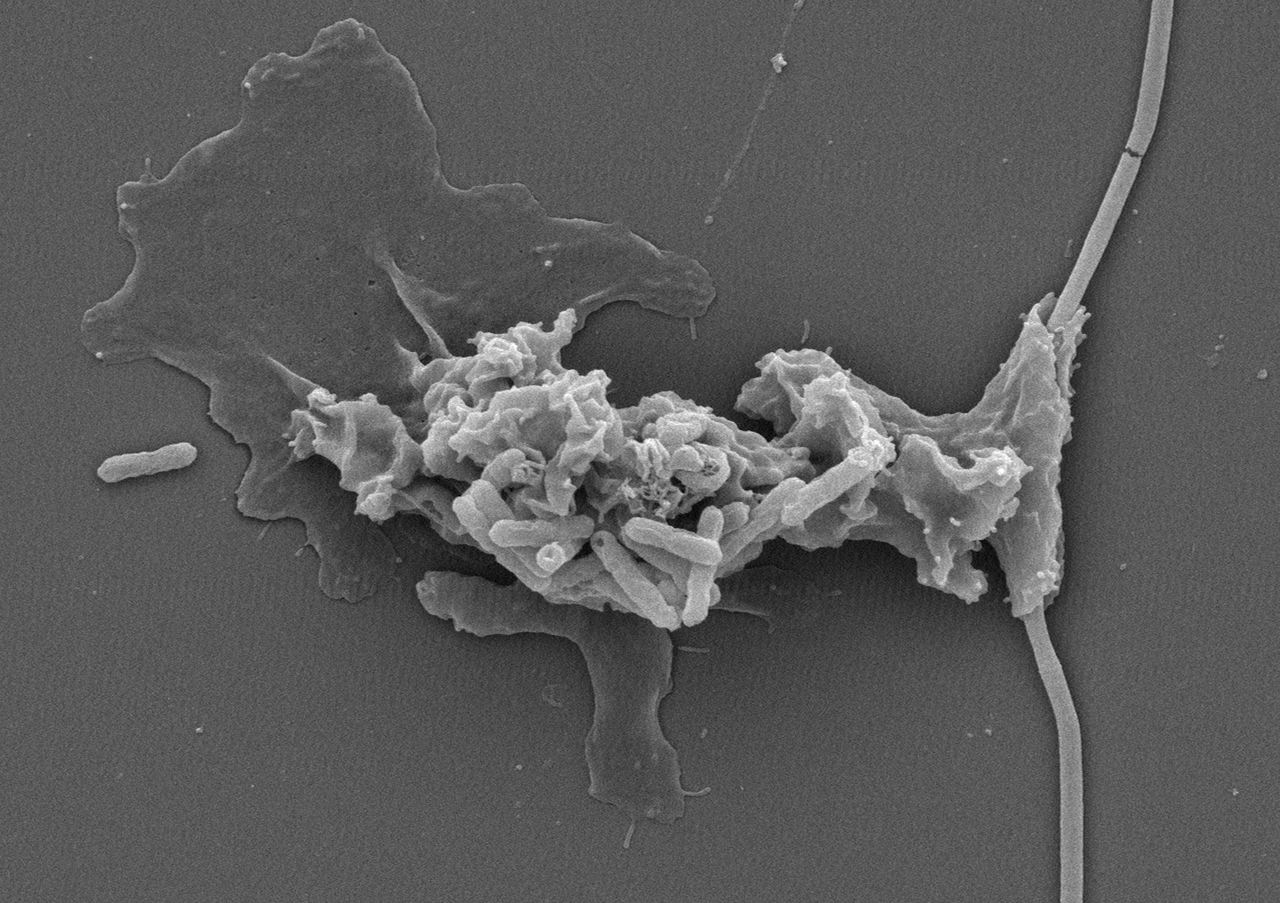 Scanning electron micrograph of amoeba-like microbe interacting with rod-shaped bacteria.